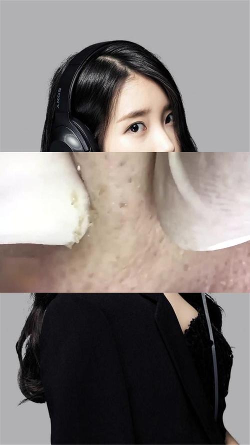 粉刺痘痘不再是烦恼,美容师都在使用,优质服务